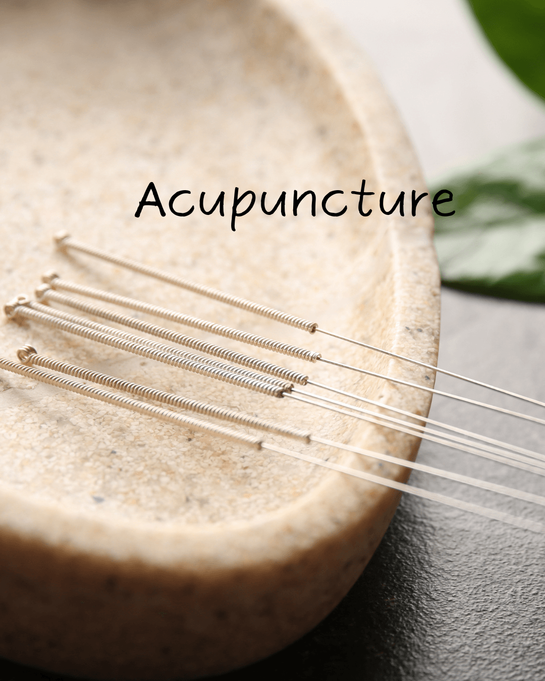 Image for Acupuncture
