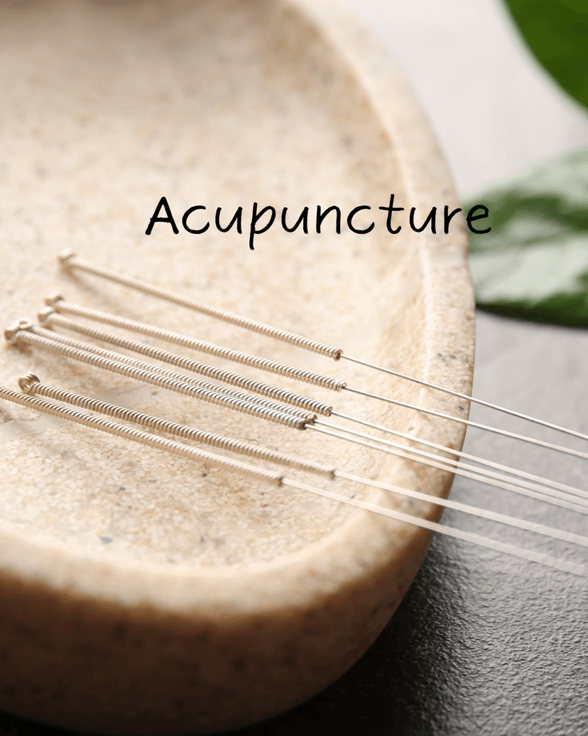 An image of Acupuncture